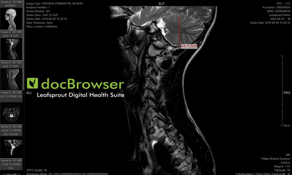 docBrowser